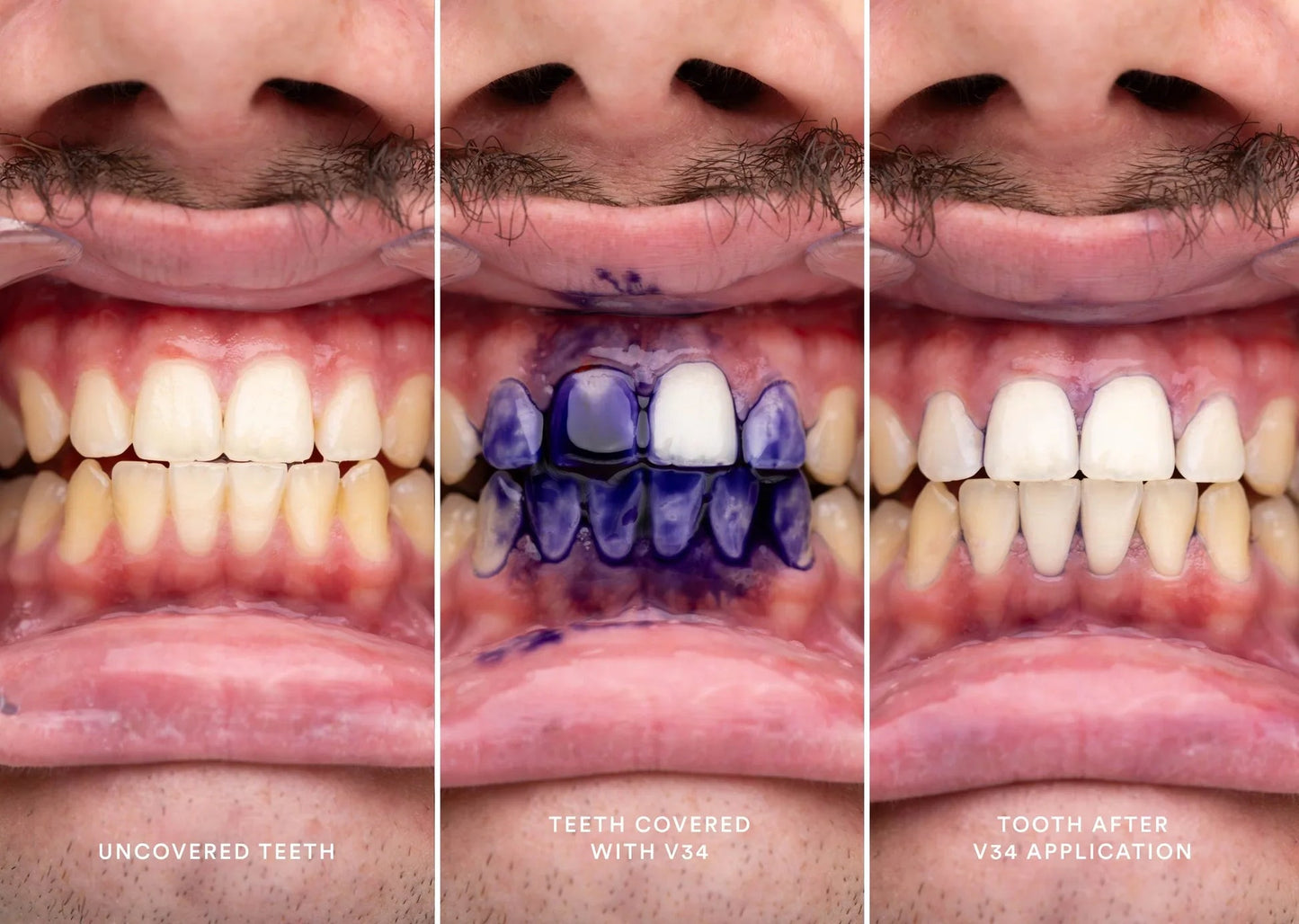 V34 Colour Corrector tooth whitening Serum
