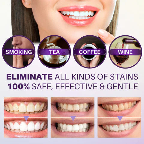 V34 Colour Corrector tooth whitening Serum